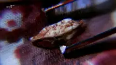 Кости 1 сезон 7 серия